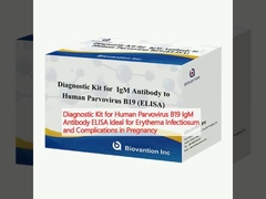 Kit de diagnóstico para o parvovírus humano B19 IgM ELISA de anticorpos Ideal para eritema infeccioso e complicações na gravidez
