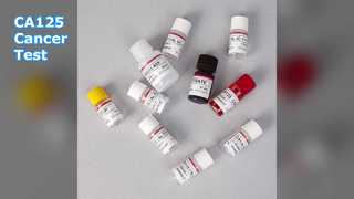 Teste CA125 ELISA para monitoramento de câncer