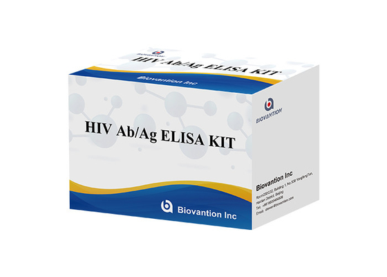 Ensaio ELISA Kit da geração do Hiv 4o do teste Ab AG de ISO13485 VIH 60 minutos
