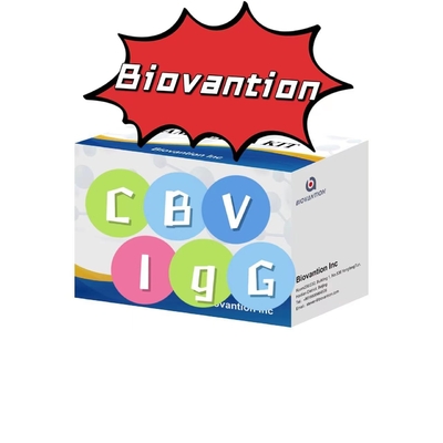 Kit de diagnóstico de anticorpos ELISA para CBV-IgG Kit de teste de soro