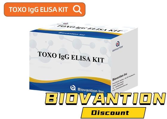 TOXO Ig G ELISA Test Kit with 99% Accuracy for Toxoplasma gondii IgG Detection, Endonuclease And Exonuclease Activity Tested, 24 Months Shelf Life
