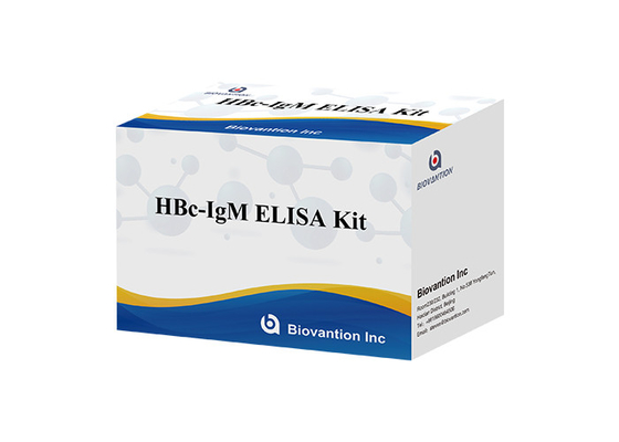 Teste de Igm do anticorpo do núcleo de Kit Hepatitis B do teste de ISO13485 HBc IgM