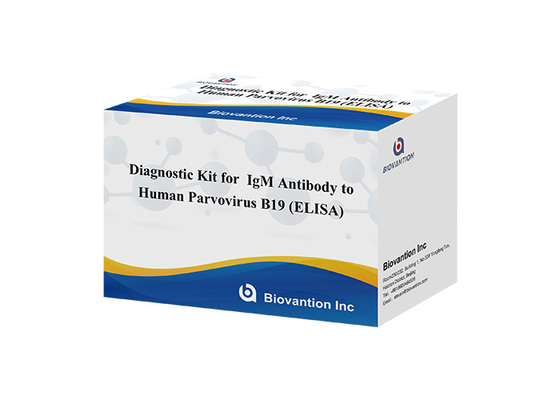 Anticorpo ao Parvovírus Humano B19 IgM Kit de Testes ELISA Kit de Diagnóstico