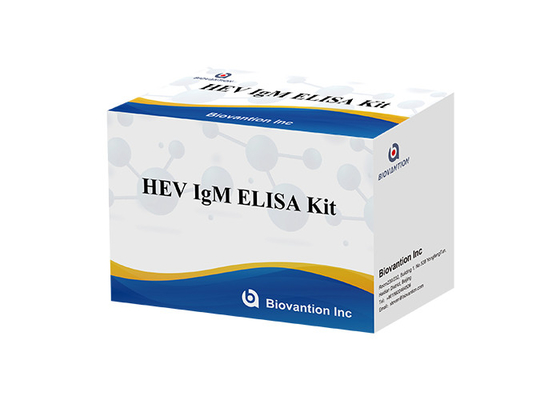 Plasma de HEV IgM Elisa Test Kit Serum Vs para a detecção do anticorpo