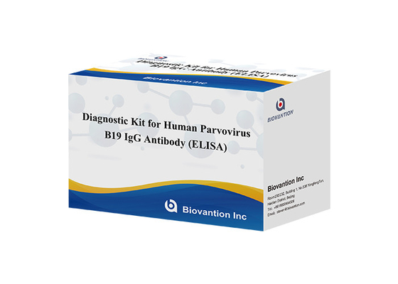 Kit de diagnóstico para o parvovírus humano B19 IgG kit de teste de ELISA anticorpo para amostras de soro