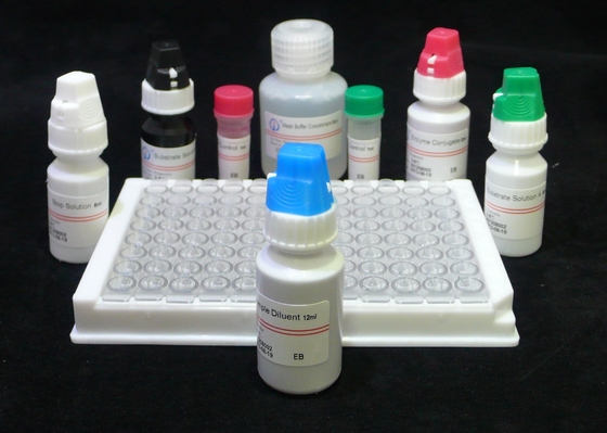 Ensaio ELISA Kit da geração do Hiv 4o do teste Ab AG de ISO13485 VIH 60 minutos