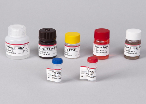 Anticorpo do vírus da imunodeficiência humana (HIV) /kit de ensaio ELISA de antígenos