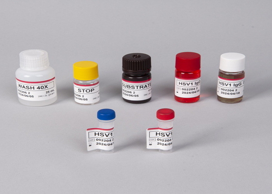 Anticorpo do vírus da imunodeficiência humana (HIV) /kit de ensaio ELISA de antígenos