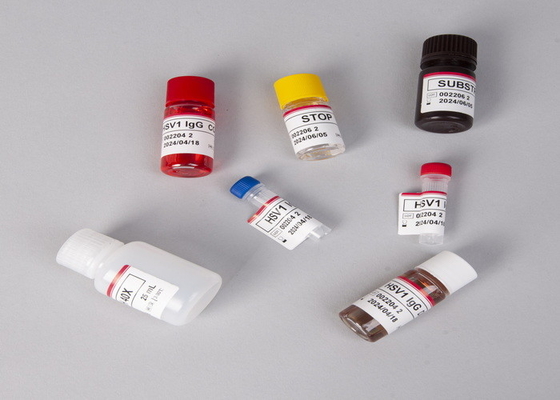 Para laboratório ou hospital Kit de ensaio Elisa de alta precisão de gonadotropina coriónica beta-humana