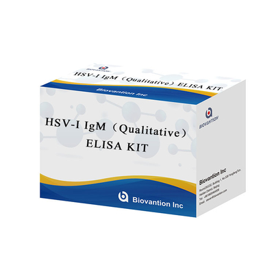INSTRUÇÕES DE USO de alta precisão de laboratório ou hospital para o kit de ensaio HSV I IgG ELISA
