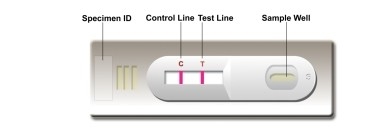 Autoteste de laboratório ou de hospital de alta precisão Leishmania Ab Combo Rapid Test