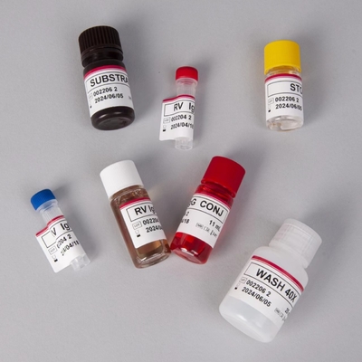 Kit de ensaio RV-G Elisa para diagnóstico do tipo de amostra de plasma
