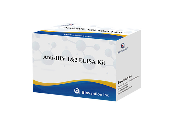 Kit de Teste Elisa HIV Vida útil de 18 meses Teste Elisa com alta sensibilidade e especificidade