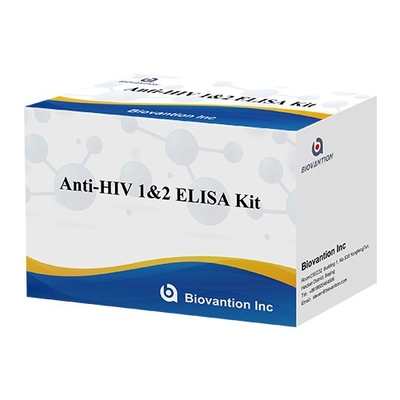 Kit de Teste Elisa HIV Vida útil de 18 meses Teste Elisa com alta sensibilidade e especificidade