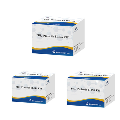 Hospitais Laboratórios Clínicas Usar Prolactina Imunoanálise Quantitativa ELISA TEST KIT