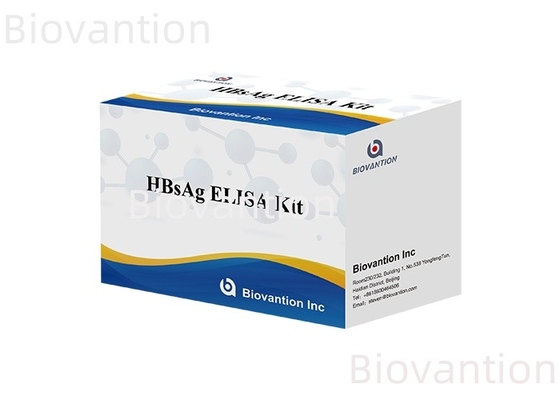 Diagnóstico preciso de HBsAg em 2-3 horas com o kit de ensaio de imunossorbentes ligados a enzimas