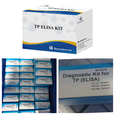 96T Solução de detecção Anticorpo sífilis Imunoanálise ligada a enzimas Kit de ensaio Elisa