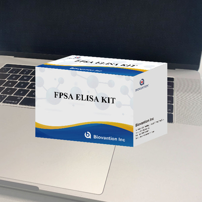 Kit de detecção de imunoanálise ELISA FPSA Kit de ensaio Elisa de antígeno prostático específico livre