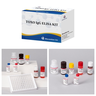 TOXO Ig G Kit de ensaio Elisa sensível e específico para monitorização da doença