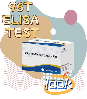 Reagente de diagnóstico de detecção humana Elisa rápido e confiável cerca de CRP 0,1-300 mg/L