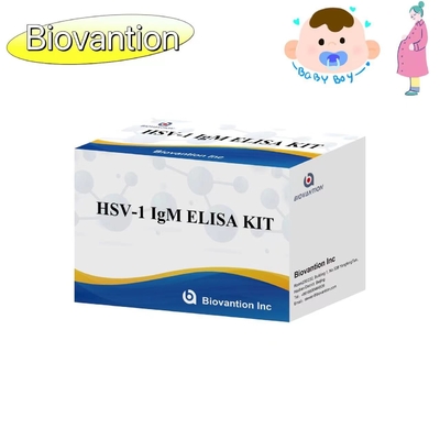 Kit de ensaio ELISA com tocha HSV 1 IgM Reagente de diagnóstico IVD de alta venda a quente