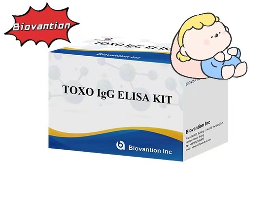 Kit de teste TOXO IgG ELISA de alta sensibilidade de tocha Teste hospitalar Verificação de gravidez