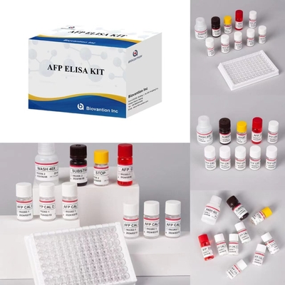 AFP Alfa-fetoproteína Kit de ensaio Elisa Produtos ligados a enzimas Tempo de transporte curto