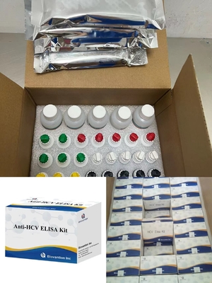 Anticorpos anti-HCV para o vírus da hepatite C Tempo de transporte ligado a enzimas curto