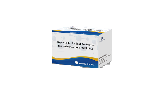 Kit de diagnóstico para o parvovírus humano B19 IgG kit de teste de ELISA anticorpo para amostras de soro