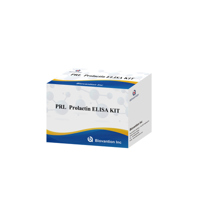 PRL Hormônios Humanos Quantitativos Kit de Reagentes de Detecção Diagnóstico