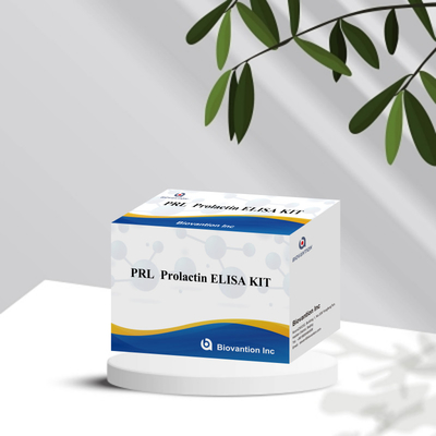 PRL Hormônios Humanos Quantitativos Kit de Reagentes de Detecção Diagnóstico