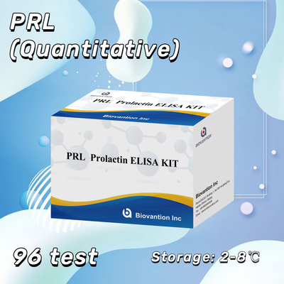 PRL Hormônios Humanos Quantitativos Kit de Reagentes de Detecção Diagnóstico