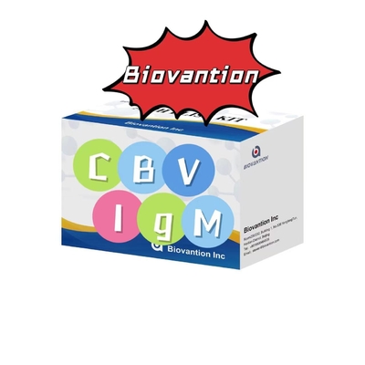 Kit de diagnóstico para anticorpos IgM contra CBV Kit de teste Elisa 50μL soro Diagnóstico médico