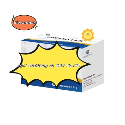 Kit de diagnóstico para anticorpos IgM contra CBV Kit de teste Elisa 50μL soro Diagnóstico médico