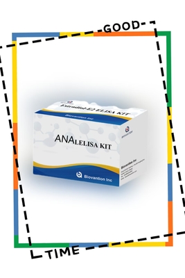 Kit de ensaio ELISA anti-ANA IgG Detecção qualitativa de anticorpos anti-IgG nucleares