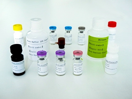 Kit de ensaio Elisa de precisão e sensibilidade para detecção rápida e fácil de tuberculose IGRA ELISA DIAGNOSE