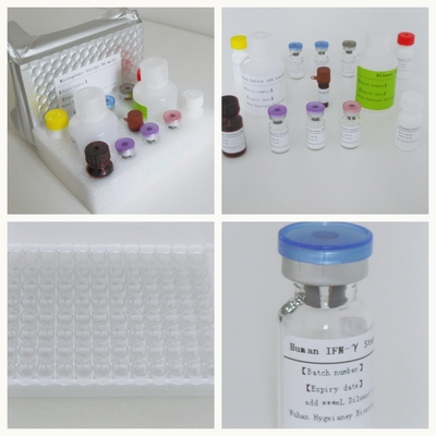 Kit de ensaio Elisa de precisão e sensibilidade para detecção rápida e fácil de tuberculose IGRA ELISA DIAGNOSE