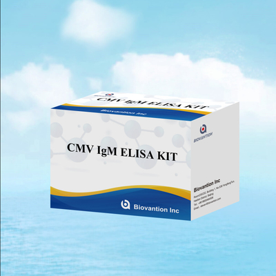 Teste ELISA qualitativo de IgM dos macrófagos Kit experimental IVD Altamente sensível