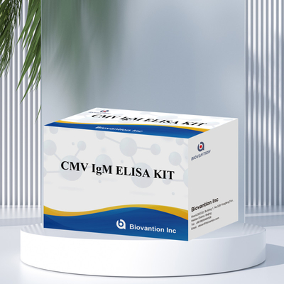 Teste ELISA qualitativo de IgM dos macrófagos Kit experimental IVD Altamente sensível