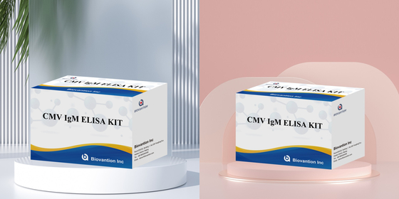 Teste ELISA qualitativo de IgM dos macrófagos Kit experimental IVD Altamente sensível