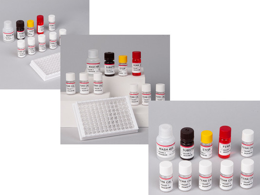 Laboratório ou Hospital High Precision Human Ferritin FE ELISA TEST KIT
