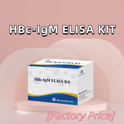 Teste com reagente de diagnóstico de antgeno IgM HBc de alta precisão com kit de teste de imunossorbente ligado a enzimas