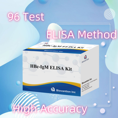 Teste com reagente de diagnóstico de antgeno IgM HBc de alta precisão com kit de teste de imunossorbente ligado a enzimas