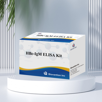 Teste com reagente de diagnóstico de antgeno IgM HBc de alta precisão com kit de teste de imunossorbente ligado a enzimas