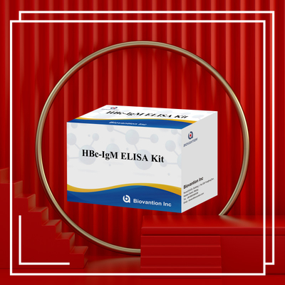 Teste com reagente de diagnóstico de antgeno IgM HBc de alta precisão com kit de teste de imunossorbente ligado a enzimas
