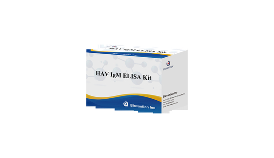 HAV IgM Elisa Test Hepatite A Kit de Diagnóstico In Vitro Enzima Immunoassay