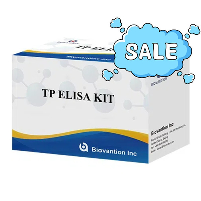 TP (Treponema pallidum) Ab Kit de ensaio ELISA Sífilis SYP Imunossorbente ligado a enzimas