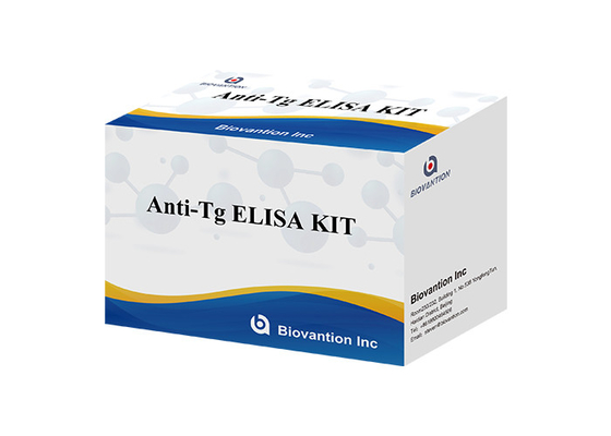 Anti-Tg ELISA Test Kit Thyroglobulin Ab In Vitro Determinação quantitativa