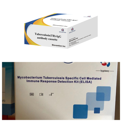 Teste Rápido de Ouro Coloidal Altamente Sensível para Tuberculose Detecção de anticorpos TB-IgG