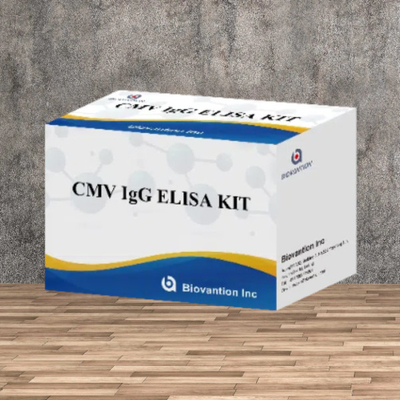 Kit de ensaio de alta precisão de IgG Elisa para CMV em laboratório ou hospital